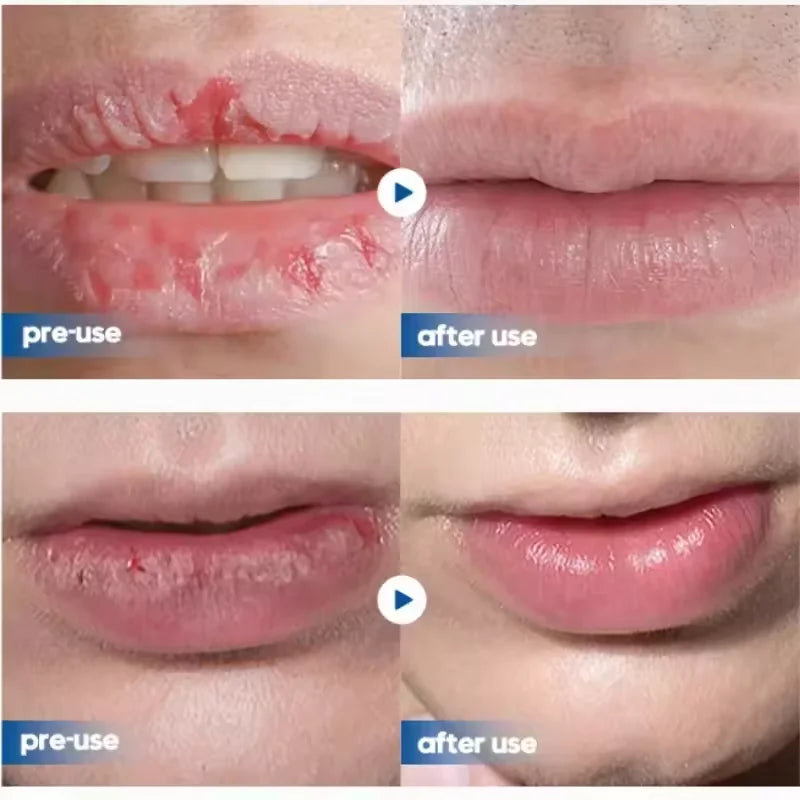 Remove Dark Lip Balm Lightening Melanin Mask Gloss Oil Exfoliating Clean Moisturizer Korean Care Products Makeup Beauty Health