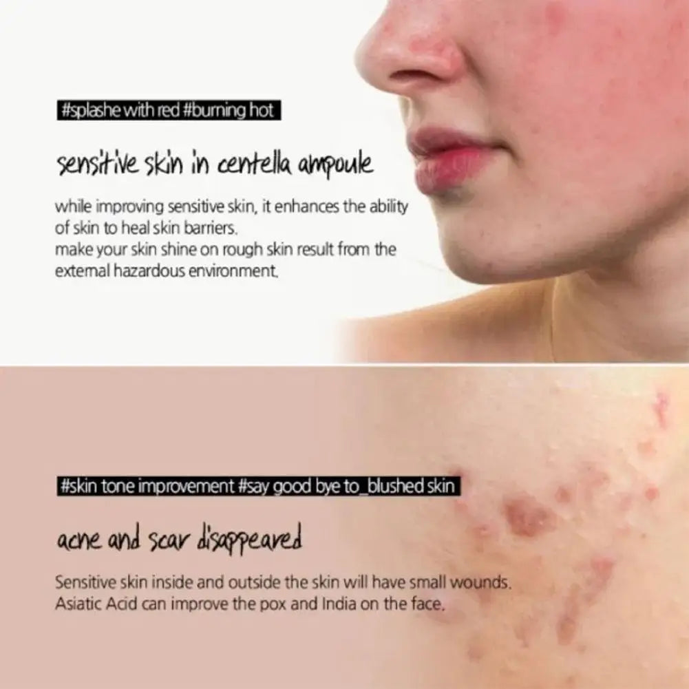 Centella Asiatica Essence Moisturizing Primer Hyaluronic Brightening Capsule Ampoule Solution Hydrating Latex Skin Care Set